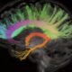 Mind stimulation can enhance the memory of older other folks